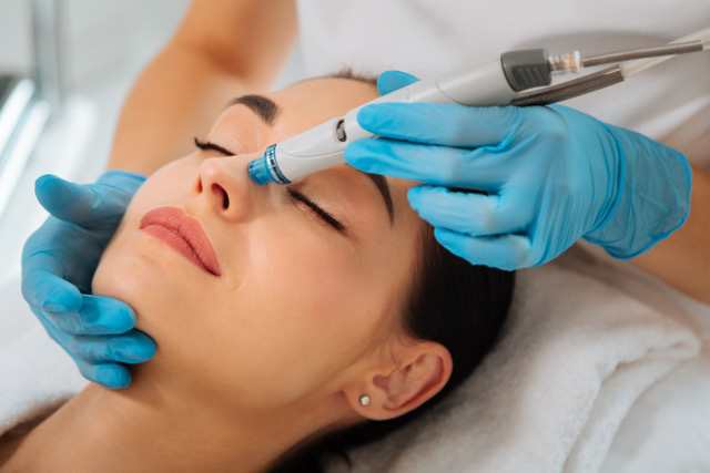 Nano Needling Behandlung an der Hautoberfläche, Pretty WoMen Berlin Wilmersdorf